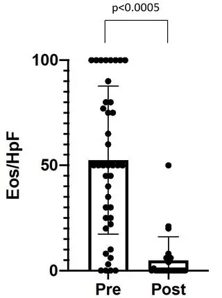 Improvement in Eosinophilic Esophagitis when using Dupilumab for other Indications or Compassionate Use