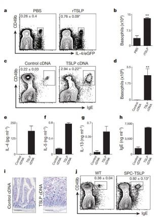 TSLP promotes interleukin-3-independent basophil haematopoiesis and type 2 inflammation