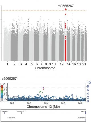 Unsupervised Modeling and Genome-Wide Association Identify Novel Features of Allergic March Trajectories