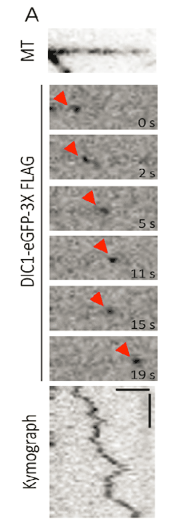 kymograph