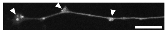 neuronal autophagy