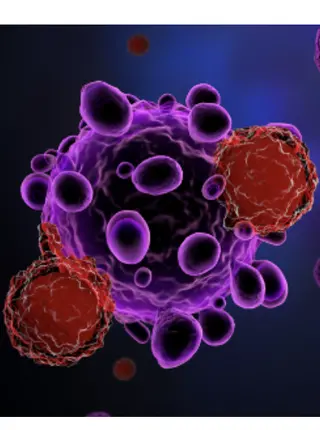 CAR T Cells May Eliminate Tumor Cells Missed by Surgery