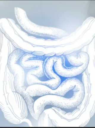 Colon Cancer Among Young Adults and Lynch Syndrome: What to Know