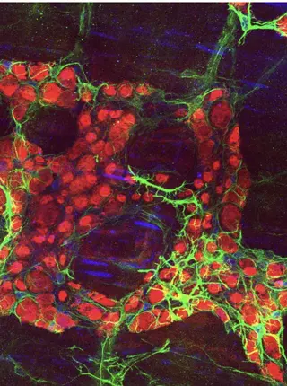 Neurons in the Gut Help Explain Why Chronic Stress Can Cause IBD Flare-Ups