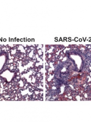 Antiviral Combination Highly Effective Against SARS-CoV-2