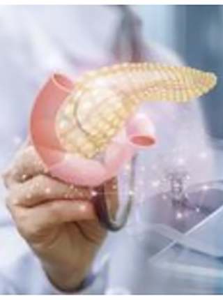 Biomarker Strategies Show Potential for Guiding Metastatic Pancreatic Cancer Treatment