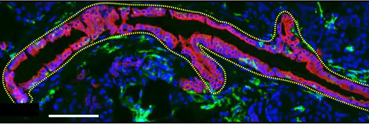 Staining of pancreas