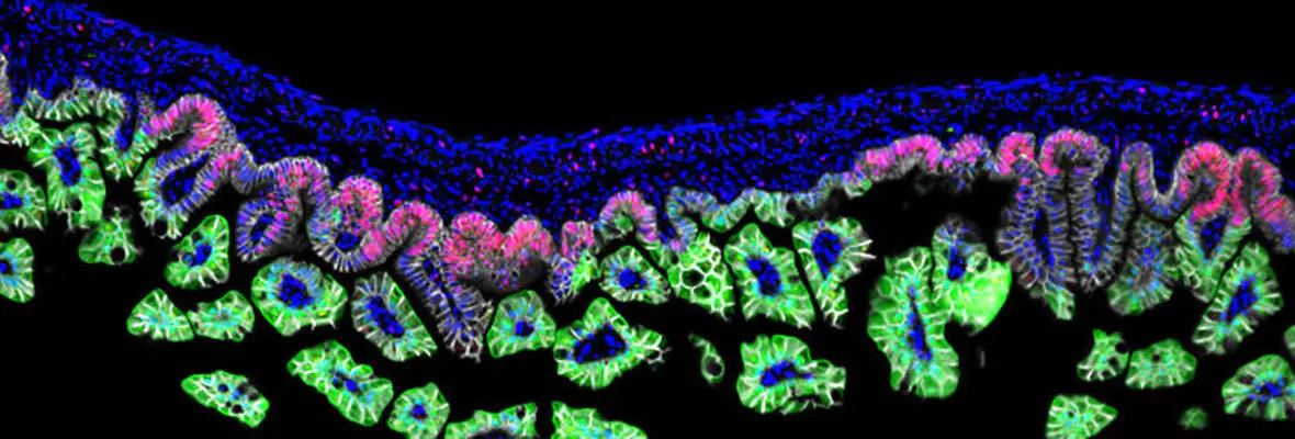 Ki67 Staining in Intestinal Tract