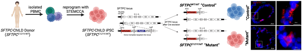 iPSC Derived iAT2 modeling of SFTPC BRICHOS mutation