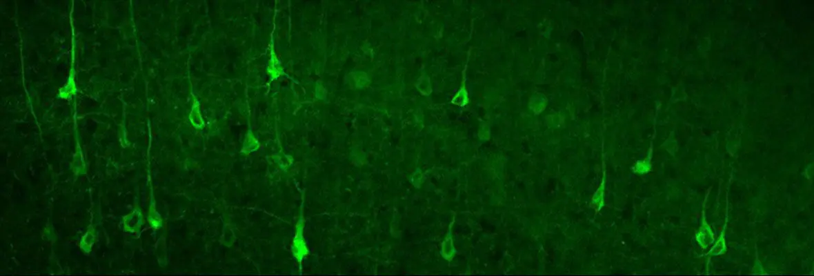 Fluorescence image of neurons