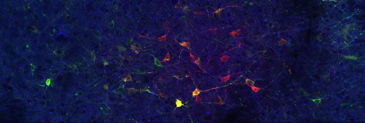 Fluorescence image of neurons