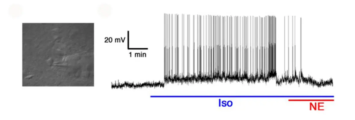 Image of single neuron electrophysiology recording