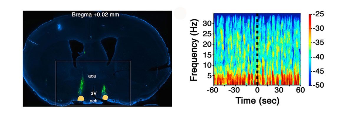 Image of EEG recording from locus coeruleus