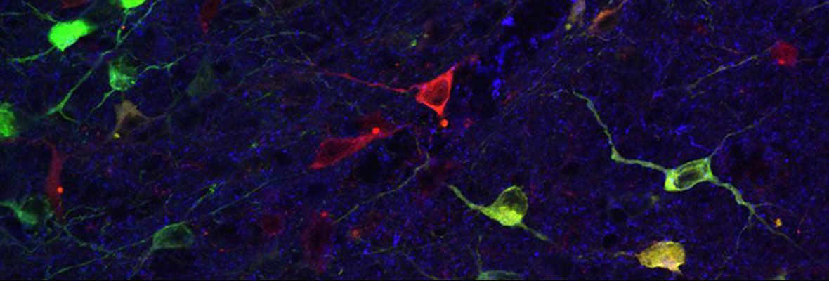 Fluorescence image of neurons