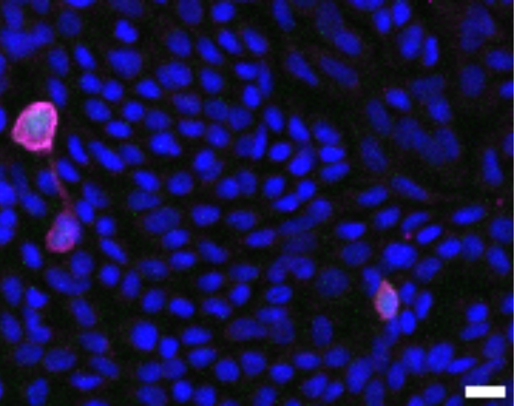 Tuft Cells