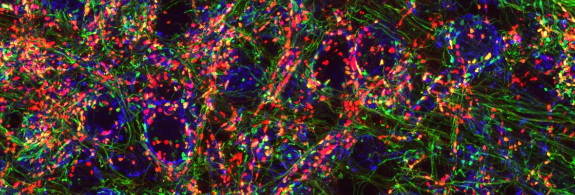 synaptic puncta in the cochlear nucleus