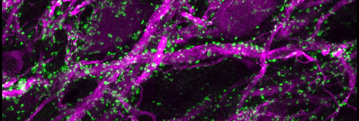 synaptic puncta on octopus cell dendrites