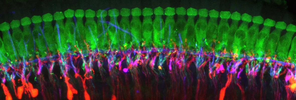 a row of inner hair cells