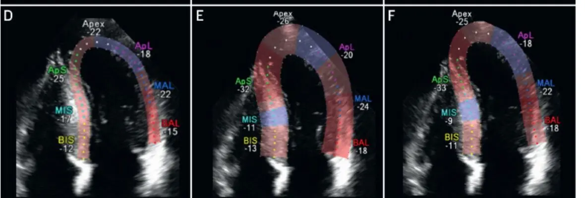 Echocardiogram image.