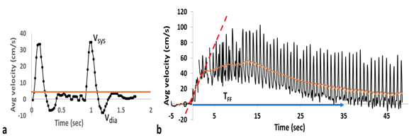 hemodynamic-evaluation-of-femoral-artery