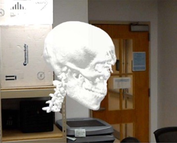 augmented-reality-generated-from-patients-ct-scan