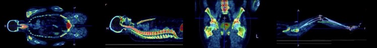 18f-sodium-fluoride-bone-images-of-subject