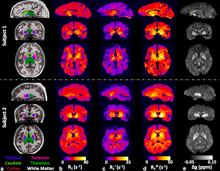 Fig4MRM2020