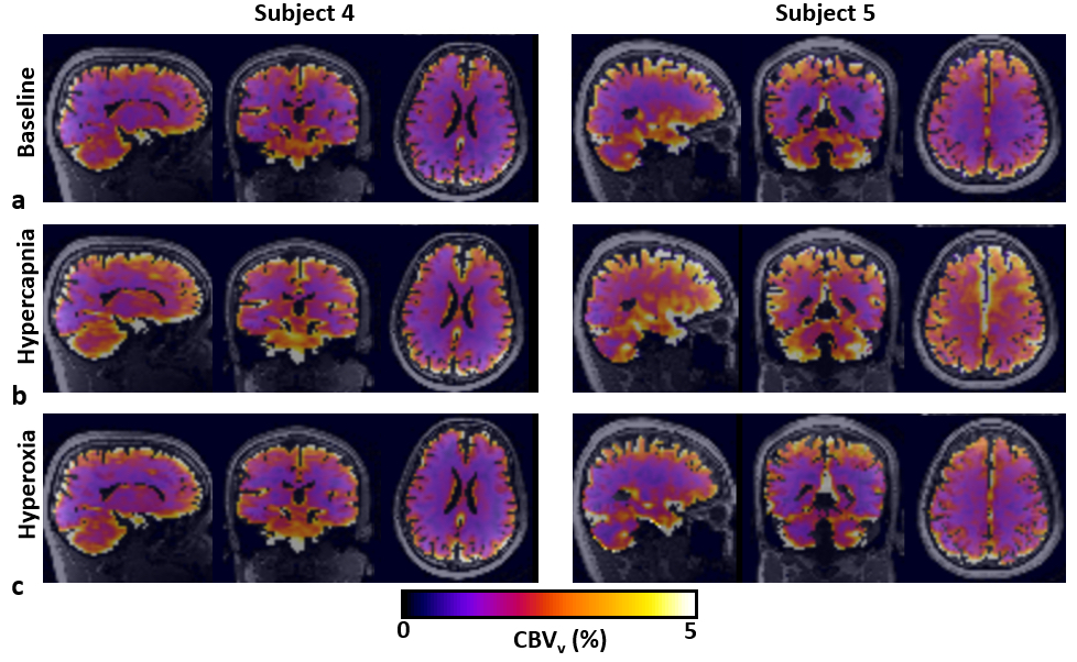 Fig5MRM2020