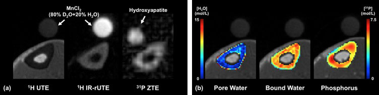 hute-hirrute-pzte-sequences-and-color-encoded-density-maps