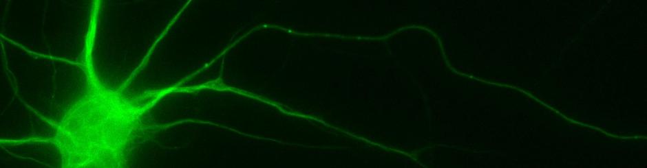 Autophagosomes in the axon of a hippocampal neuron