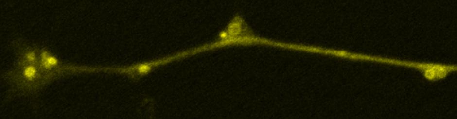 Axonal autophagosomes in a dorsal root ganglion neuron