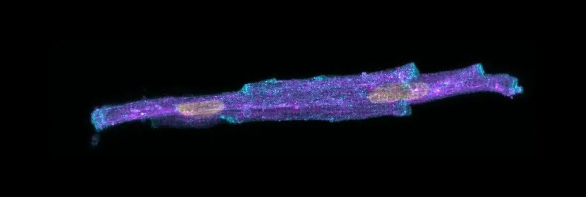 myocardial remodeling imaging