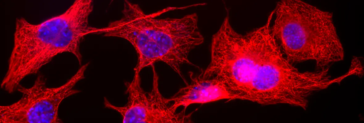 fluorescence microscopy - red microtubules and blue nuclei