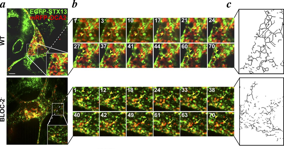 Microscope images of BLOC-2 showing recycling endosomal tubules delivering cargo to maturing melanosomes