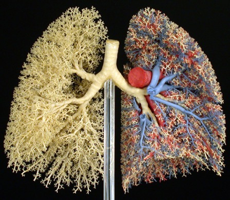 MFB Lung