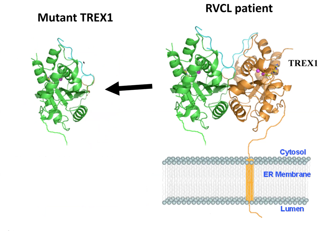RVCL mutant TREX1