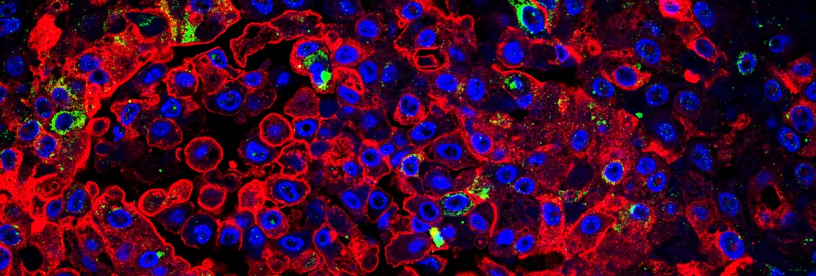 immunostained human lung