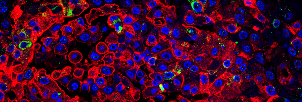 immunostained human lung