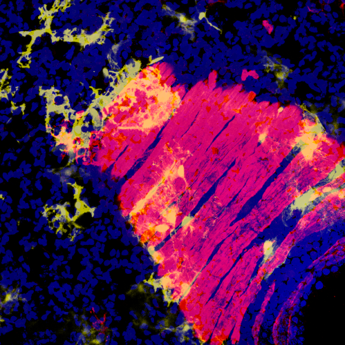 immunnostaining