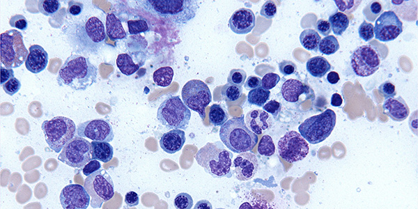 Penn Center for Myeloproliferative Neoplasms image