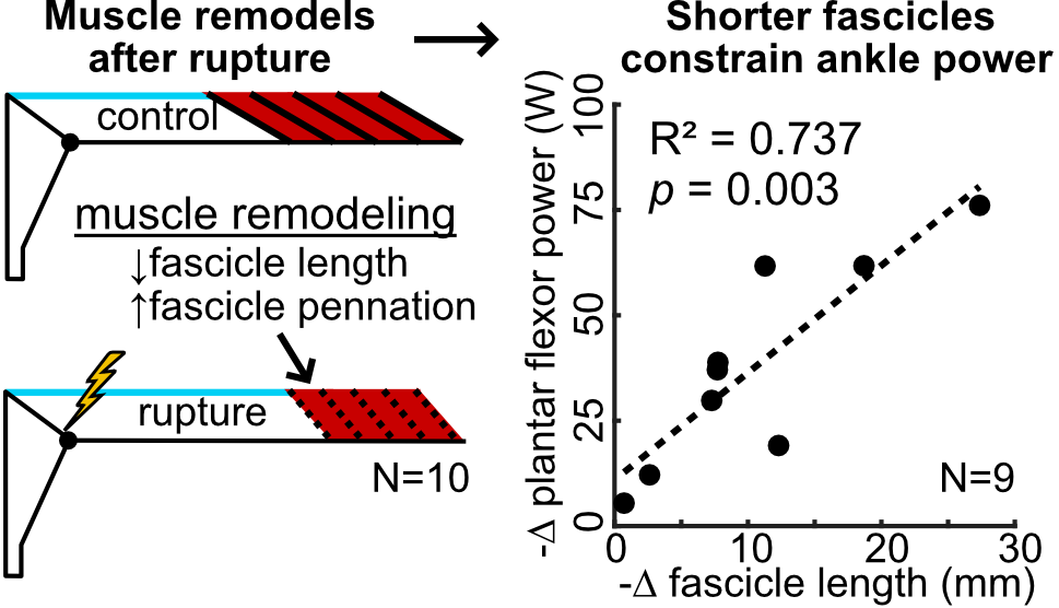 Schematic of muscle changes following tendon rupture