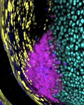 Using Col1a1-GFPTpz, Col2a1-CFP, and Col10a1-mcherry triple reporter mice, we have demonstrated the formation of the mineralized fibrocartilage zone in the Achilles tendon enthesis. Cells at the base of the collagen fibers (SHG) of the enthesis (white arrow) transition from unmineralized to mineralized chondrocytes at this age. They do so by expressing IHH (blue) and alkaline phosphatase (AP, magenta). This process establishes a cellular maturation gradient of Col1a1-expressing cells of the midsubstance to Col2a1-expressing unmineralized fibrochondrocytes to Col10a1-expressing mineralized fibrochondrocytes.