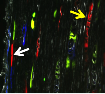 Clonal expansion of elongated (white arrow) and cuboidal (yellow arrow) internal tendon fibroblasts, highlighting distinct cell morphologies within the tendon midsubstance.