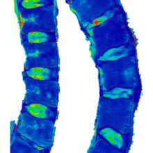 Two lumbar spine MRIs from human donors of various ages
