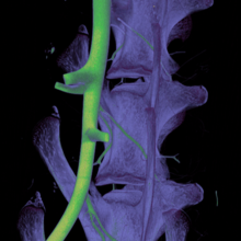 MicroFIL enhanced microCT of the rabbit lumbar spine