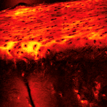 Second harmonic generation imaging of organized collagen in the human cartilage endplate