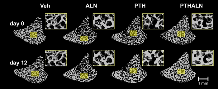 3D bone structures over 12 days of treatment