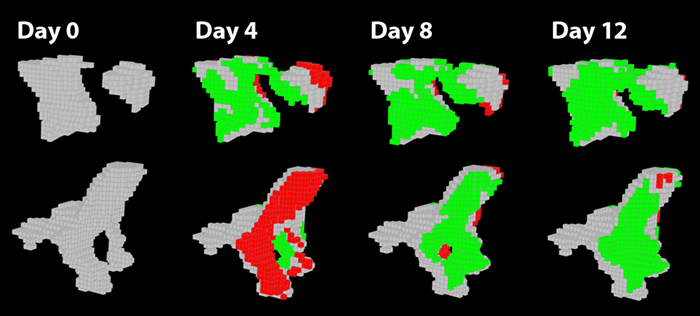 bone remodeling