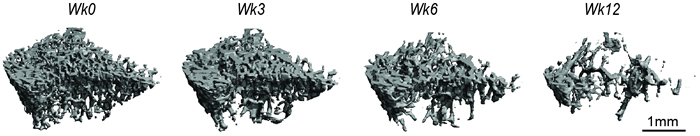 3D rendering of trabecular bone microarchitecture