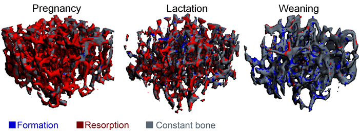 Bone remodeling during pregnancy, lactation, and weaning